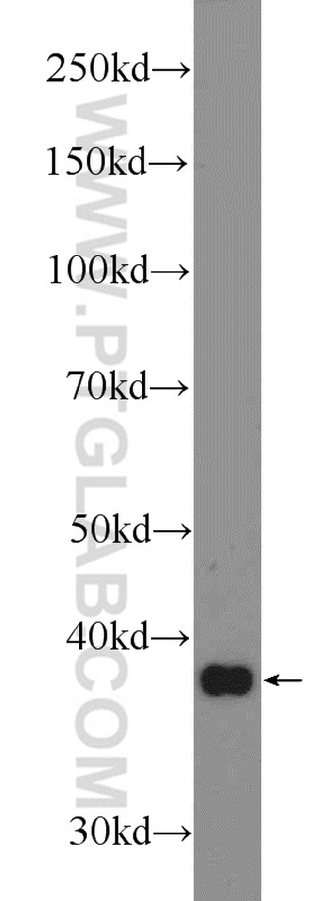 LPPR2 Antibody in Western Blot (WB)