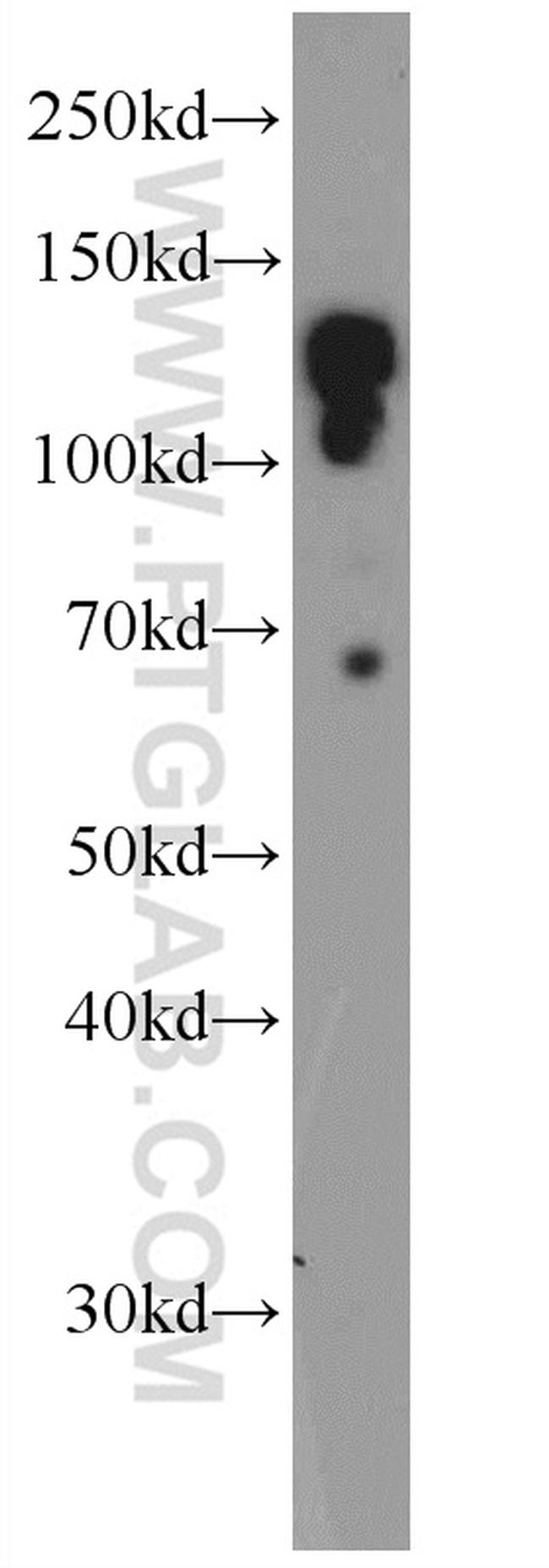 AZI1 Antibody in Western Blot (WB)