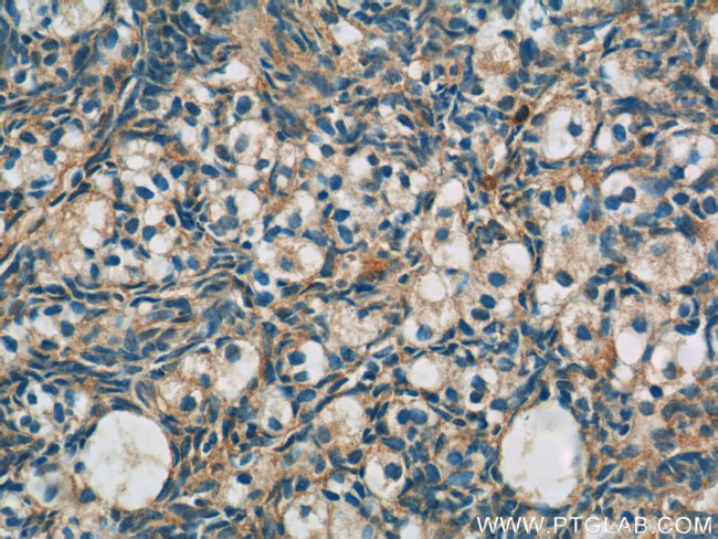 ANKRD54 Antibody in Immunohistochemistry (Paraffin) (IHC (P))