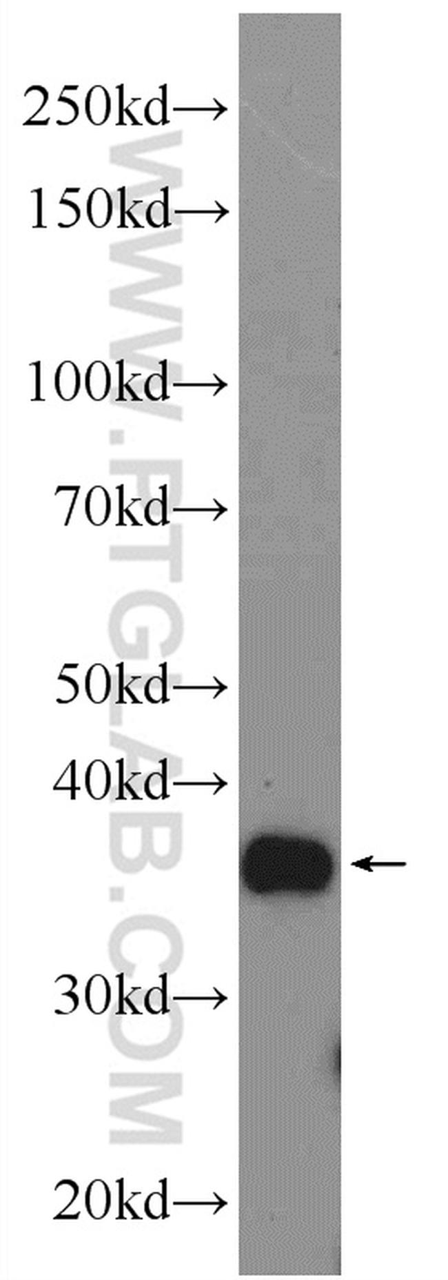 ANKRD54 Antibody in Western Blot (WB)