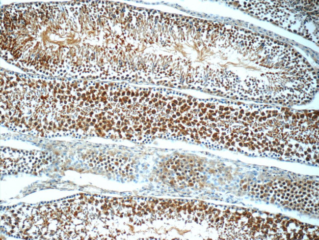 ANKRD54 Antibody in Immunohistochemistry (Paraffin) (IHC (P))