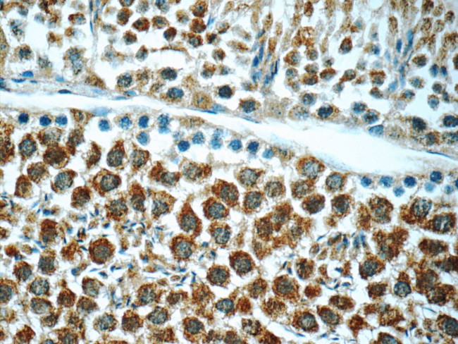 ANKRD54 Antibody in Immunohistochemistry (Paraffin) (IHC (P))