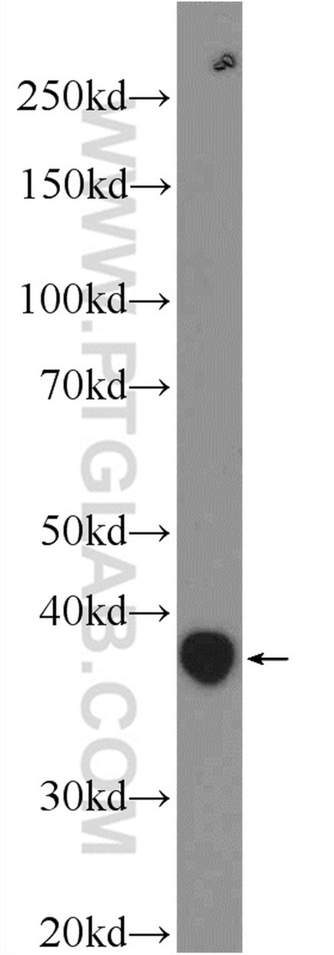 ANKRD54 Antibody in Western Blot (WB)