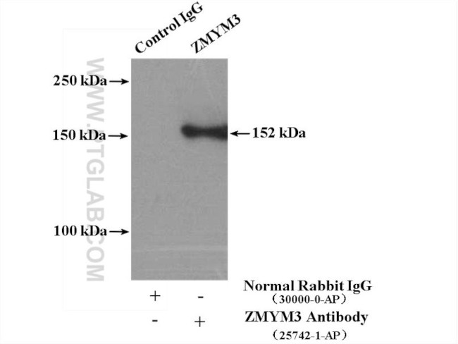 ZMYM3 Antibody in Immunoprecipitation (IP)