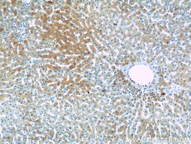 RAPH1 Antibody in Immunohistochemistry (Paraffin) (IHC (P))