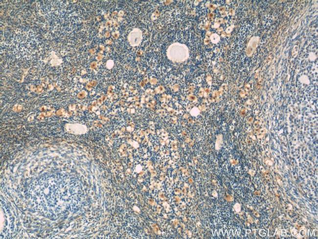 RAPH1 Antibody in Immunohistochemistry (Paraffin) (IHC (P))