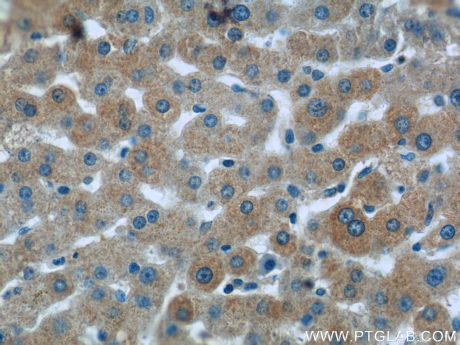 RAPH1 Antibody in Immunohistochemistry (Paraffin) (IHC (P))