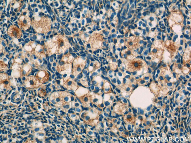 RAPH1 Antibody in Immunohistochemistry (Paraffin) (IHC (P))