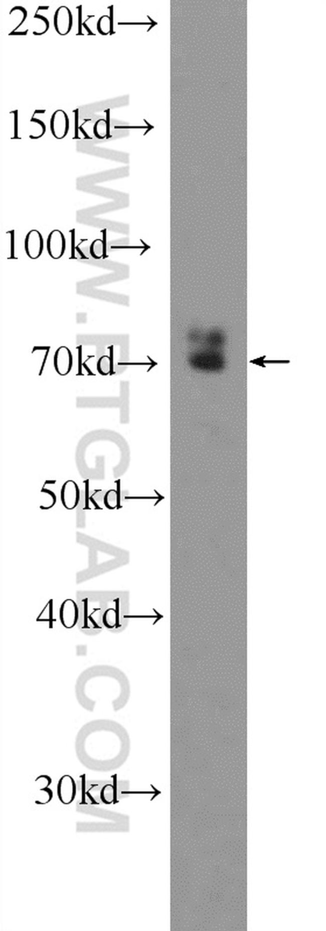 RAPH1 Antibody in Western Blot (WB)