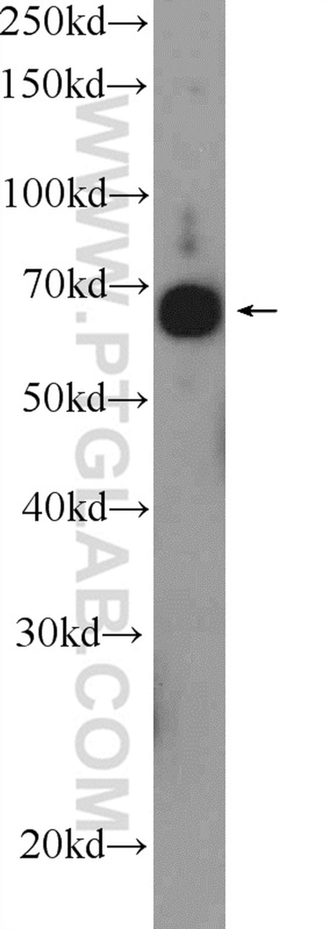 RAPH1 Antibody in Western Blot (WB)