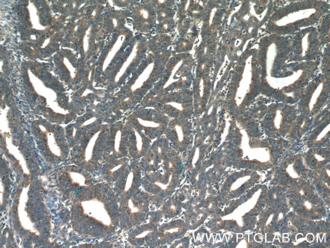 COX20 Antibody in Immunohistochemistry (Paraffin) (IHC (P))