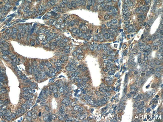 COX20 Antibody in Immunohistochemistry (Paraffin) (IHC (P))