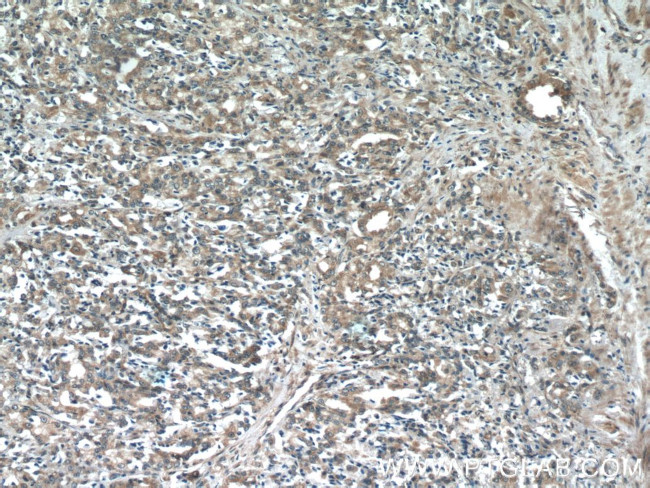 COX20 Antibody in Immunohistochemistry (Paraffin) (IHC (P))