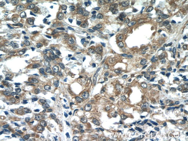 COX20 Antibody in Immunohistochemistry (Paraffin) (IHC (P))