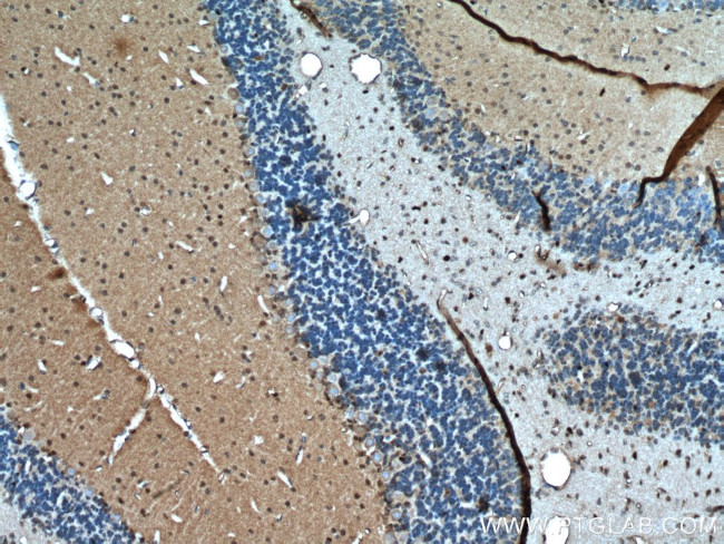 OLIG2 Antibody in Immunohistochemistry (Paraffin) (IHC (P))