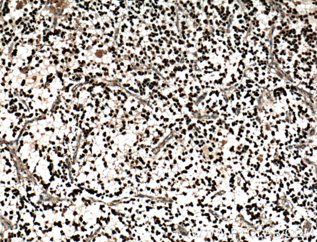 OLIG2 Antibody in Immunohistochemistry (Paraffin) (IHC (P))