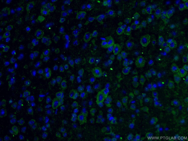 C9orf72 Antibody in Immunohistochemistry (PFA fixed) (IHC (PFA))