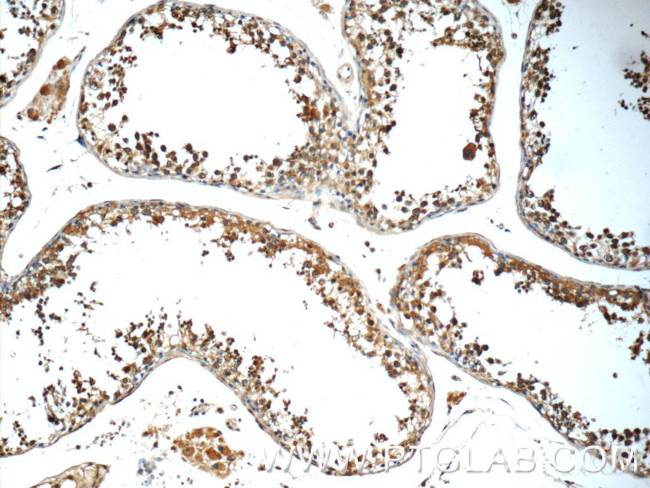 C9orf72 Antibody in Immunohistochemistry (Paraffin) (IHC (P))