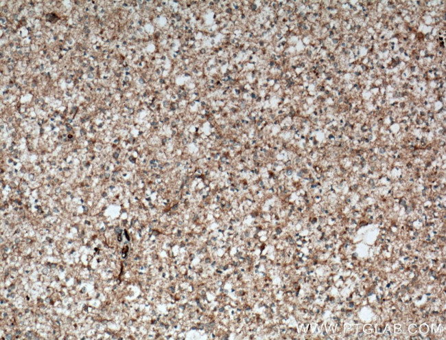 C9orf72 Antibody in Immunohistochemistry (Paraffin) (IHC (P))