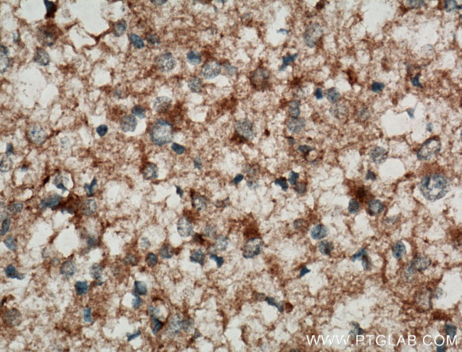 C9orf72 Antibody in Immunohistochemistry (Paraffin) (IHC (P))