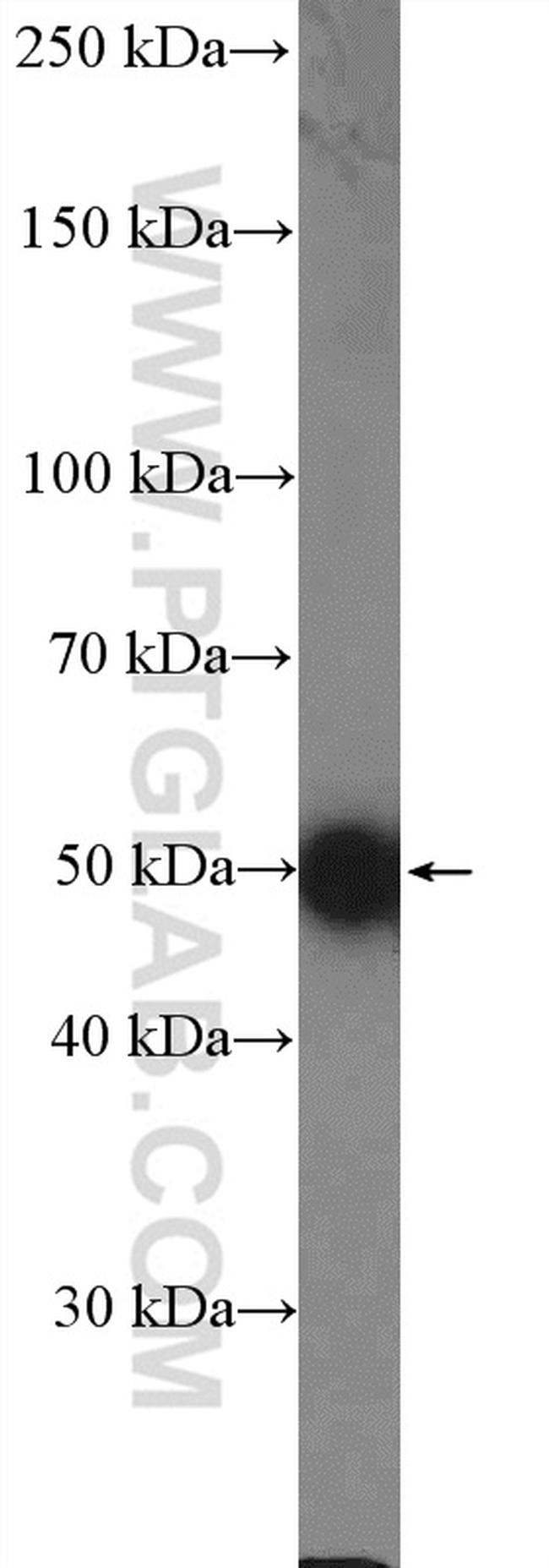 C9orf72 Antibody in Western Blot (WB)