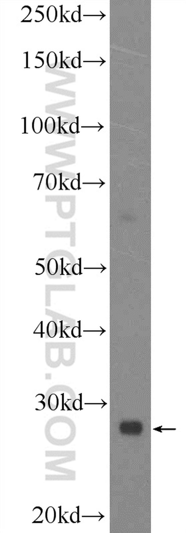 C9orf72 Antibody in Western Blot (WB)