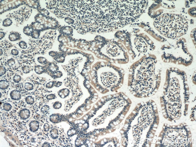 DEFB121 Antibody in Immunohistochemistry (Paraffin) (IHC (P))