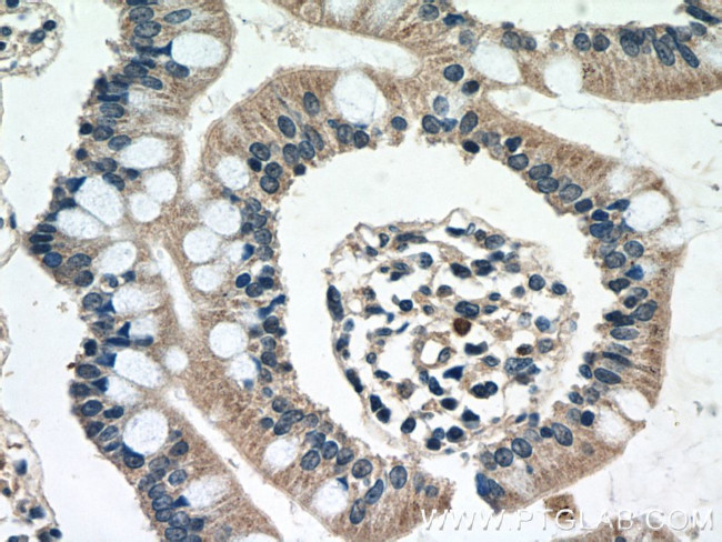 DEFB121 Antibody in Immunohistochemistry (Paraffin) (IHC (P))