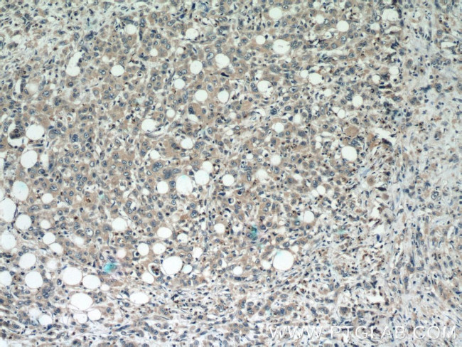 DEFB121 Antibody in Immunohistochemistry (Paraffin) (IHC (P))