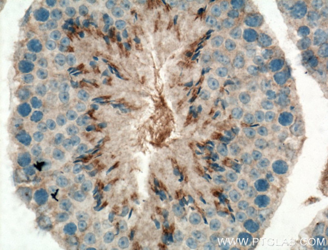 C1orf113 Antibody in Immunohistochemistry (Paraffin) (IHC (P))