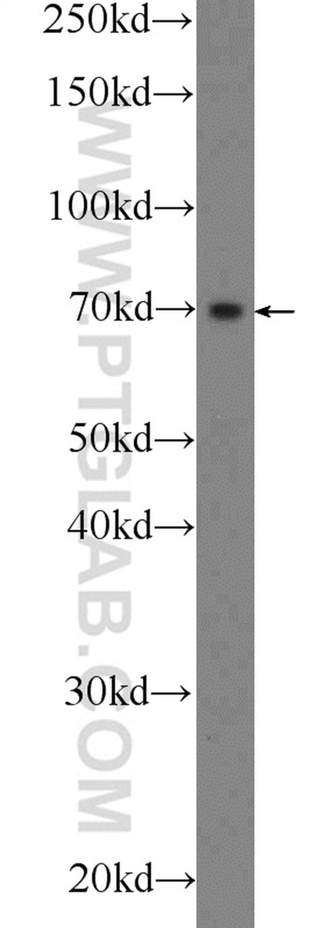 C1orf113 Antibody in Western Blot (WB)