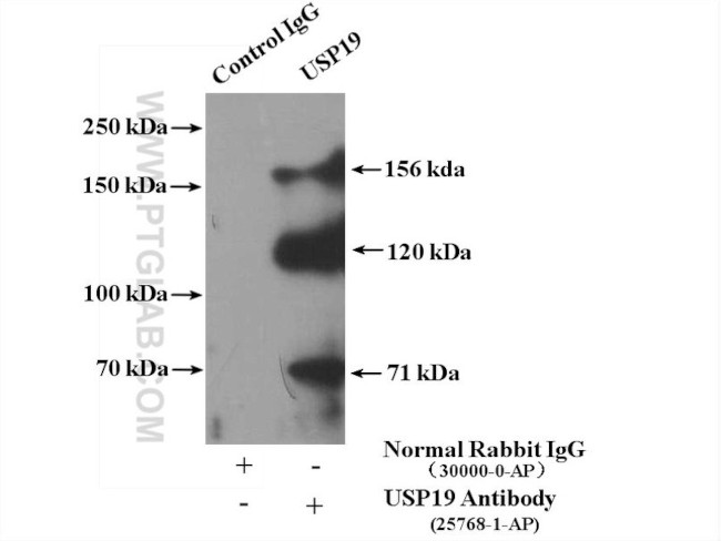 USP19 Antibody in Immunoprecipitation (IP)