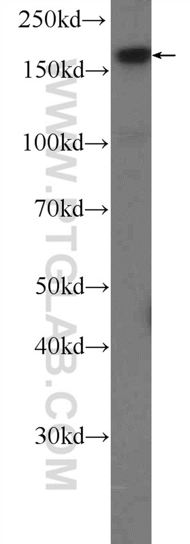 USP19 Antibody in Western Blot (WB)