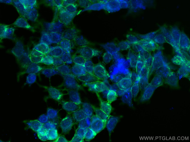 Drebrin Antibody in Immunocytochemistry (ICC/IF)