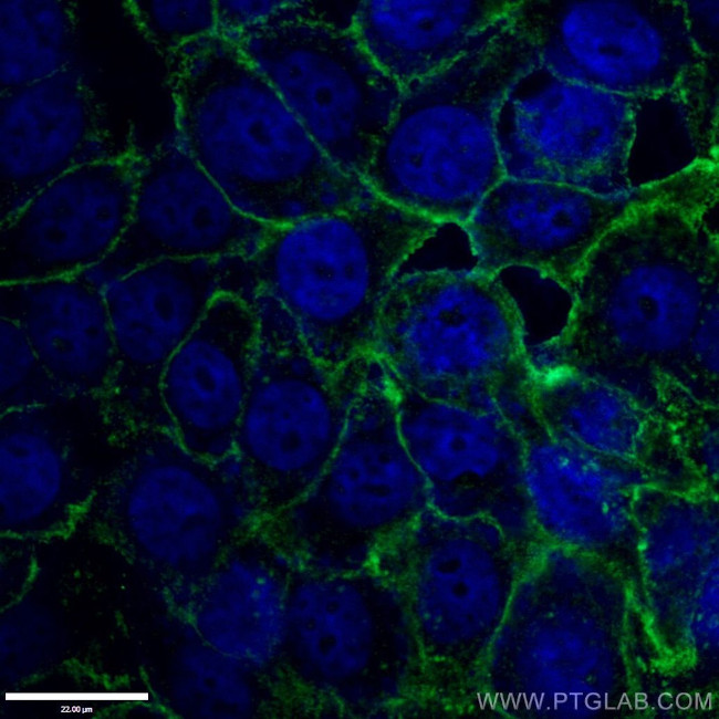 Drebrin Antibody in Immunocytochemistry (ICC/IF)