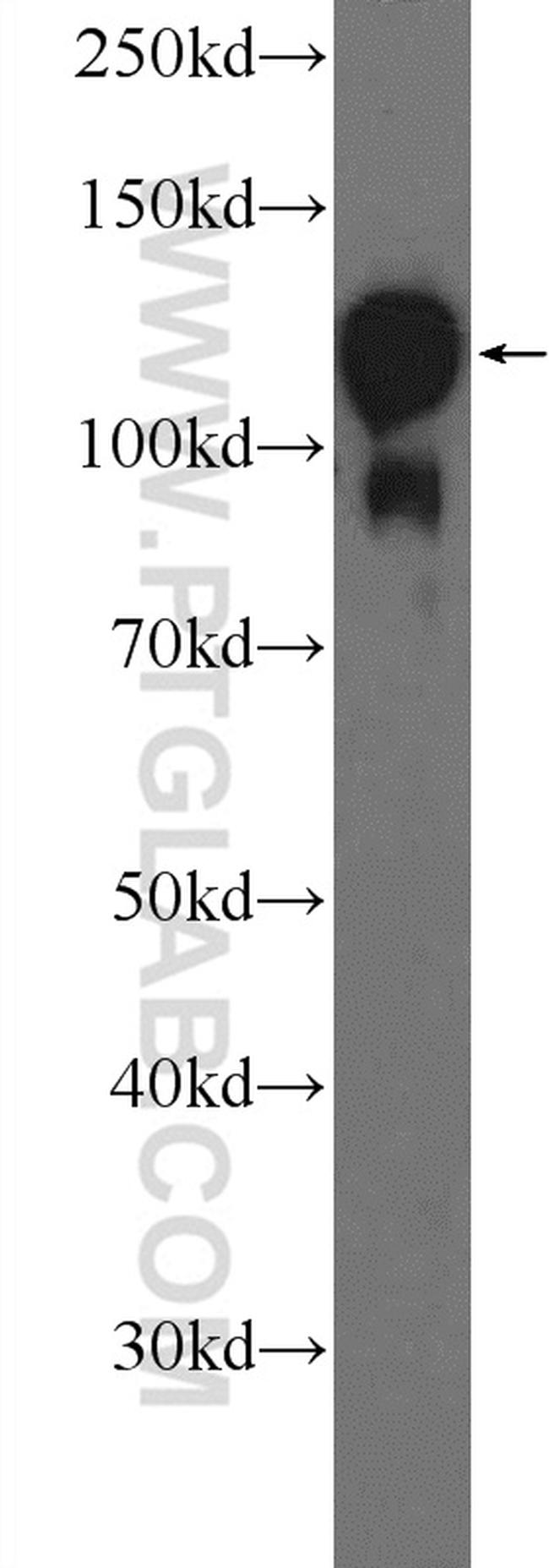 Drebrin Antibody in Western Blot (WB)