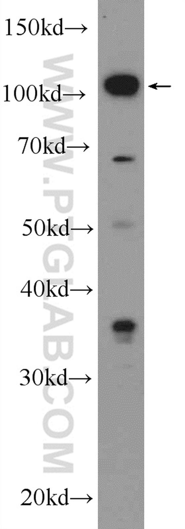 Drebrin Antibody in Western Blot (WB)