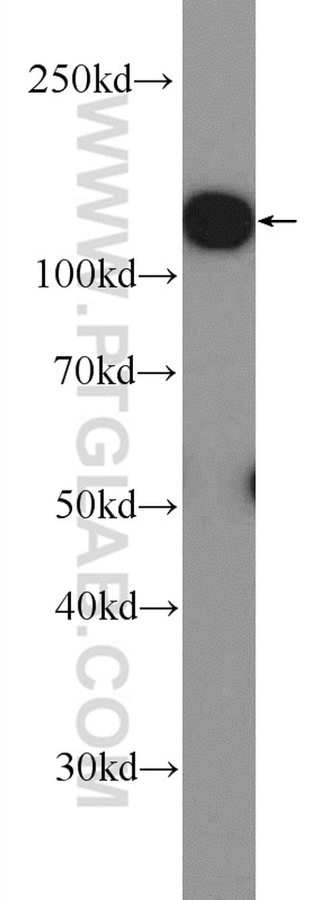 Drebrin Antibody in Western Blot (WB)