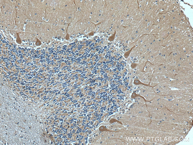 GRIK1 Antibody in Immunohistochemistry (Paraffin) (IHC (P))