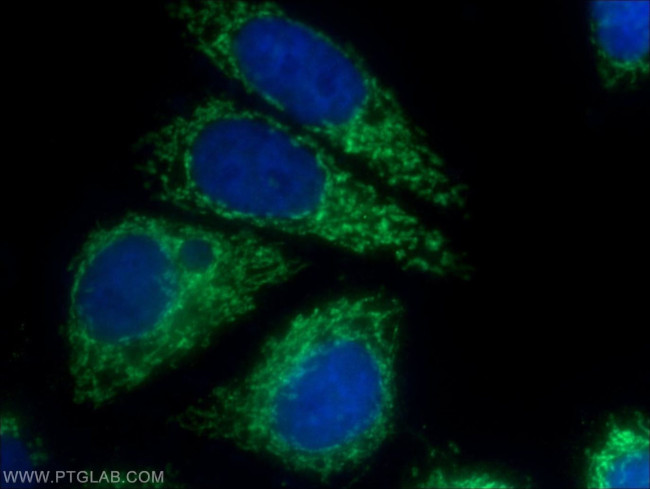 UQCC2 Antibody in Immunocytochemistry (ICC/IF)