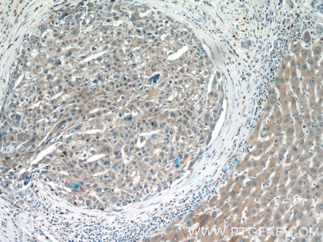 UQCC2 Antibody in Immunohistochemistry (Paraffin) (IHC (P))