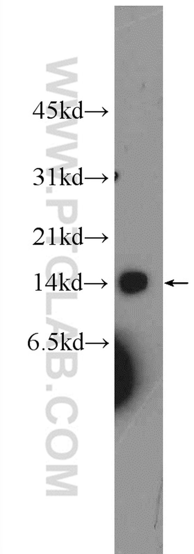 UQCC2 Antibody in Western Blot (WB)