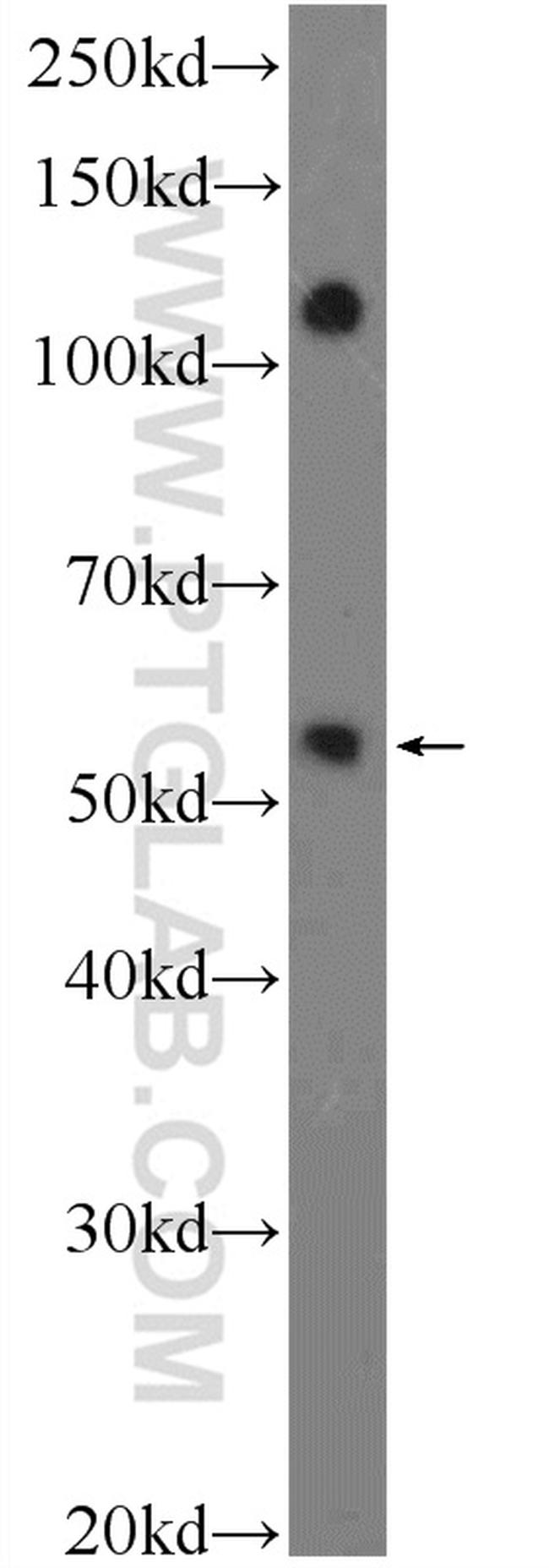 ZNF394 Antibody in Western Blot (WB)