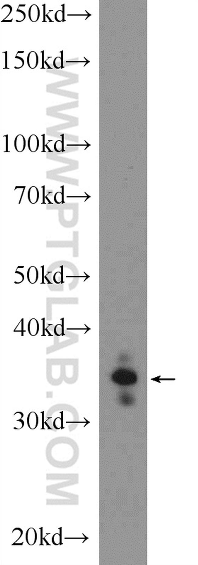 PHOX2A Antibody in Western Blot (WB)