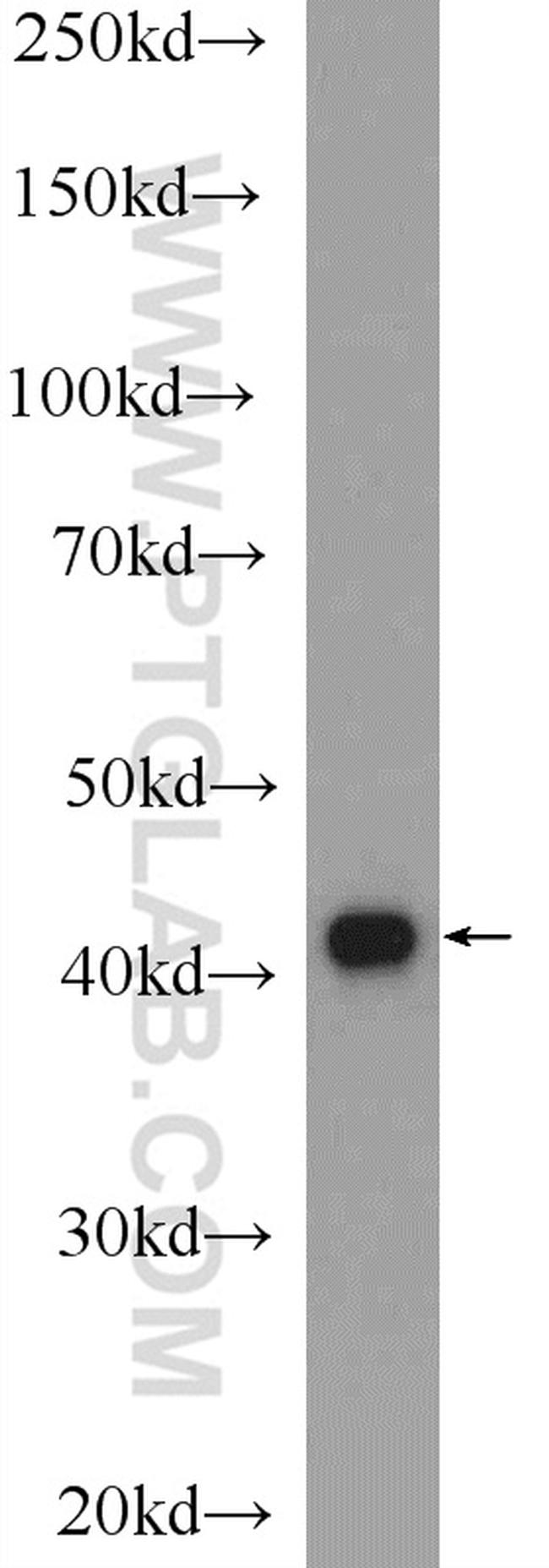 PHOX2A Antibody in Western Blot (WB)