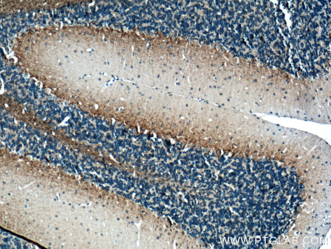 NF-M Antibody in Immunohistochemistry (Paraffin) (IHC (P))