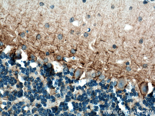 NF-M Antibody in Immunohistochemistry (Paraffin) (IHC (P))