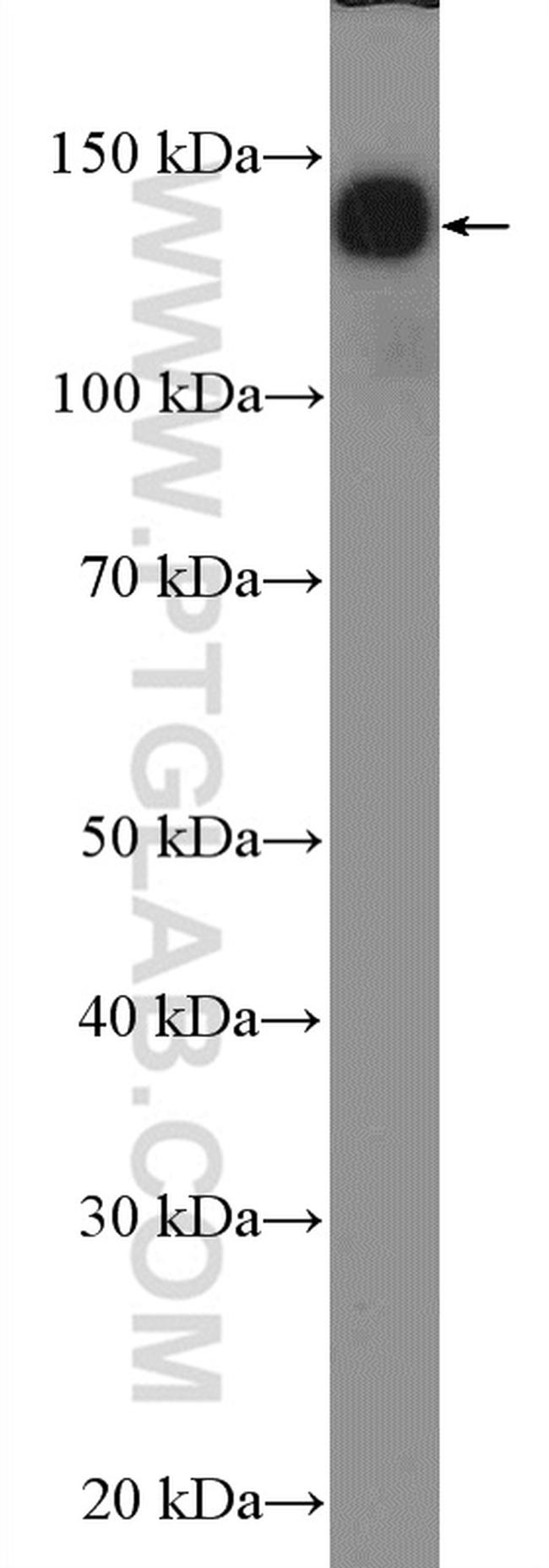 NF-M Antibody in Western Blot (WB)