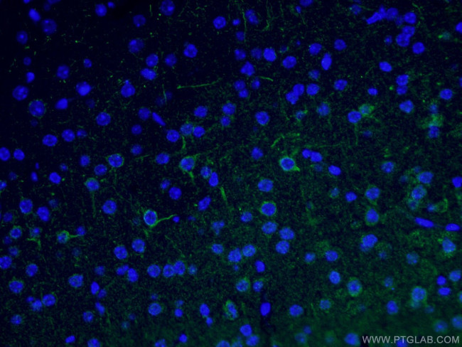 NF-M Antibody in Immunohistochemistry (PFA fixed) (IHC (PFA))