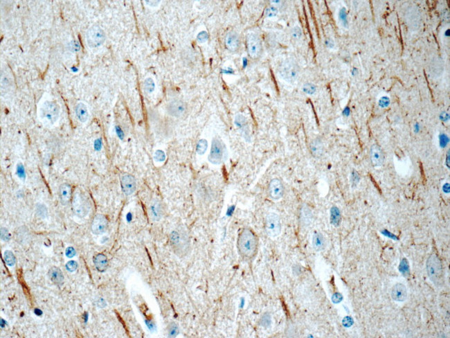 NF-M Antibody in Immunohistochemistry (Paraffin) (IHC (P))